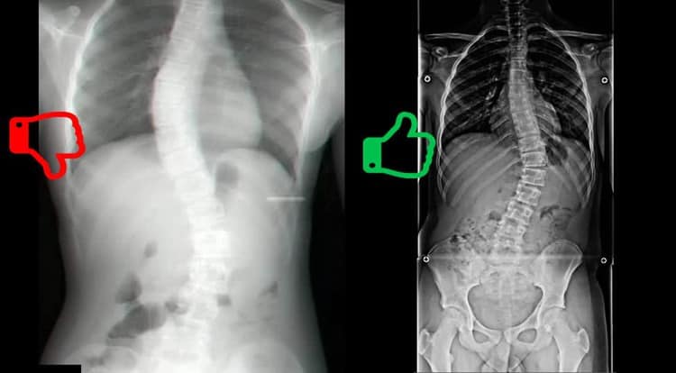Radiografia panorâmica da coluna vertebral
