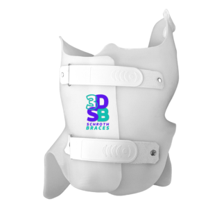 Colete para escoliose 3D Schroth 2