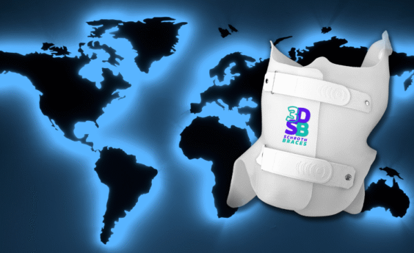 Ilustração detalhada do Colete 3D Schroth, usado no tratamento para escoliose.